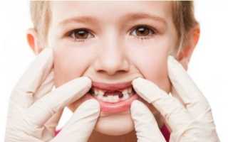 Когда начинают выпадать молочные зубы у детей