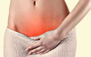 Кольпит при беременности: возможные риски и направления лечения