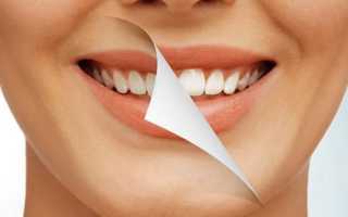 Какие методы отбеливания зубов существуют?