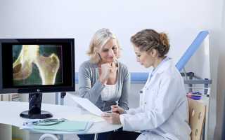 По каким признакам проявляется остеопороз: симптомы и лечение у женщин
