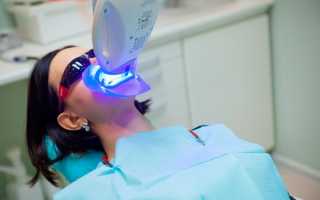 Отбеливание зубов: вред и польза современных методов