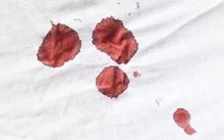 Кровотечение во время или после полового акта