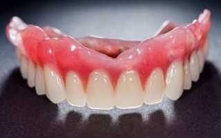 Как привыкнуть к съемным зубным протезам — мнения специалистов и отзывы людей