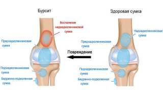 Заболевания коленного сустава — названия и классификация болезней, их лечение
