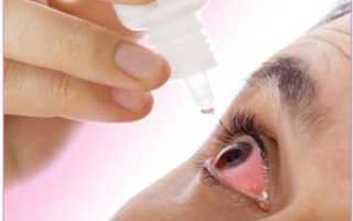Симптом каких болезней – красные глаза: причины и лечение