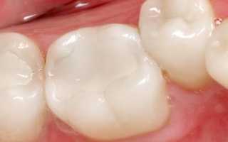 Можно ли лечить зубы во время месячных?