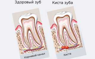 Почему остался корень при удалении зуба — к какому доктору обратиться
