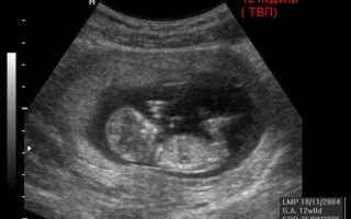 12 акушерская неделя беременности: изменения в организме, развитие ребёнка, рекомендации мамам