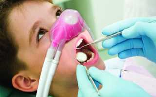 Закись азота в стоматологии детям