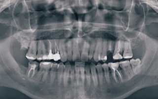Правильная диагностика в стоматологии – гарантия успешного лечения!