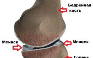 Каковы последствия операции на мениске коленного сустава