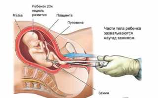 Тесты на беременность: виды и правила использования