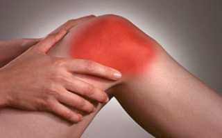 Лечение боли в коленях народными средствами