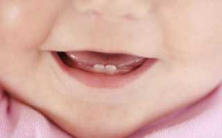 Прорезывание зубов у детей: последовательность до года