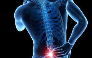Ноющая и острая боль в спине в области поясницы: причины и как лечить