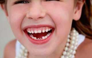Как выдернуть молочный зуб в домашних условиях?