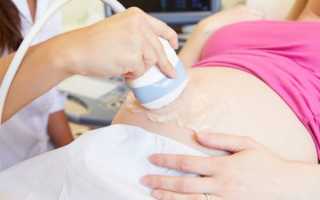 Отрыжка у беременных: как избавиться от неприятного симптома